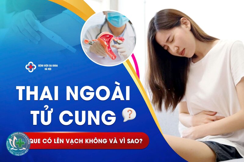 thai ngoài tử cung thử que có lên 2 vạch không - Que thử chỉ trả lời câu hỏi "có thai hay không" thai ngoài tử cung thử que có lên 2 vạch không - Que thử chỉ trả lời câu hỏi "có thai hay không"