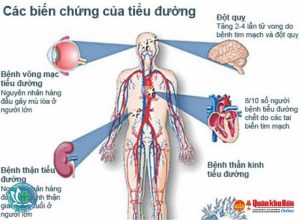 tieu duong 1