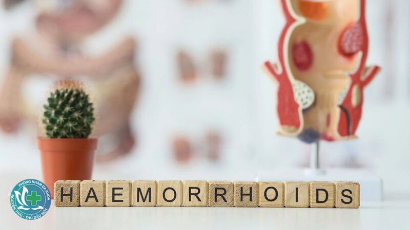 trĩ nội là gì - Bảng so sánh nhanh trĩ nội và trĩ ngoại trĩ nội là gì - Bảng so sánh nhanh trĩ nội và trĩ ngoại