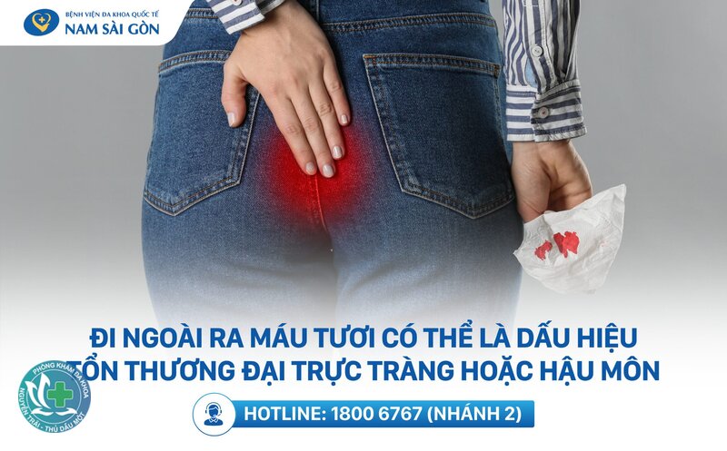 Trĩ ra máu tươi - Bác sĩ chẩn đoán như thế nào? Trĩ ra máu tươi - Bác sĩ chẩn đoán như thế nào?