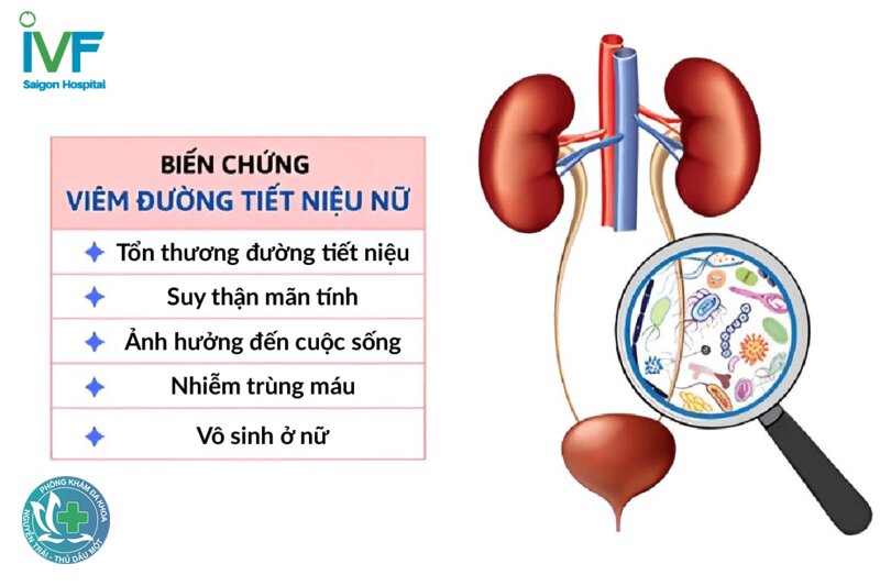 Viêm đường tiết niệu - Dấu hiệu viêm đường tiết niệu Viêm đường tiết niệu - Dấu hiệu viêm đường tiết niệu