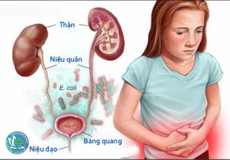 Viêm đường tiết niệu - Những bệnh nào dễ bị nhầm? Viêm đường tiết niệu - Những bệnh nào dễ bị nhầm?