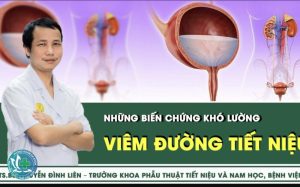 viem duong tiet nieu co tu khoi khong 1