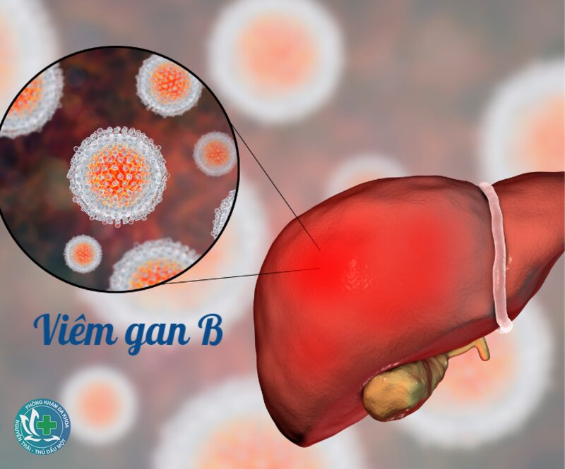 Viêm gan B - Nhiễm cấp và mạn khác nhau thế nào? Viêm gan B - Nhiễm cấp và mạn khác nhau thế nào?