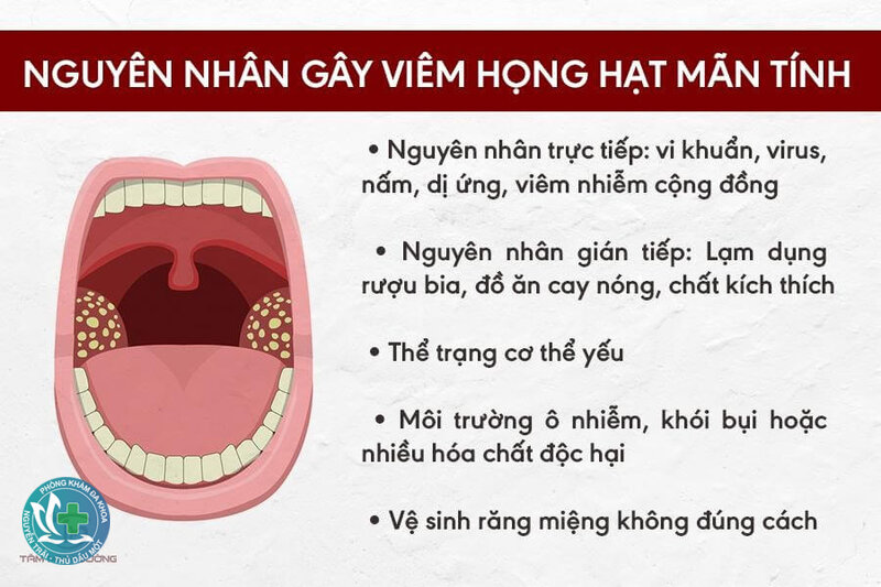 Viêm họng hạt - Nhiễm trùng và sức khỏe răng miệng Viêm họng hạt - Nhiễm trùng và sức khỏe răng miệng