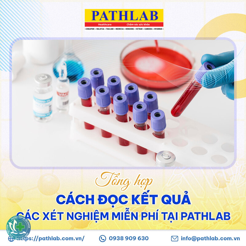 xét nghiệm máu bao lâu có kết quả - Cấy máu và xét nghiệm vi sinh: lâu nhất