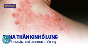 zona than kinh 1